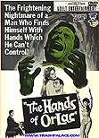 Hands of Orlac (1960) - Mel Ferrer and Christopher Lee